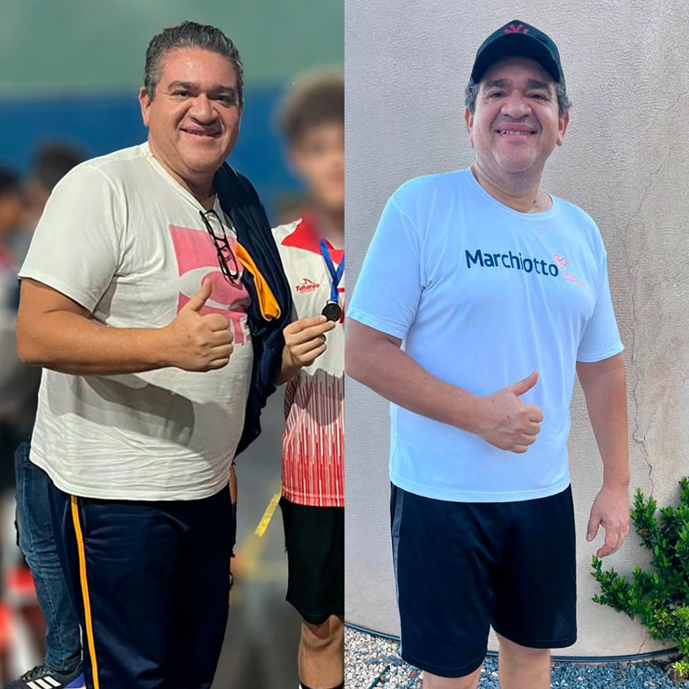 antes-depois-3