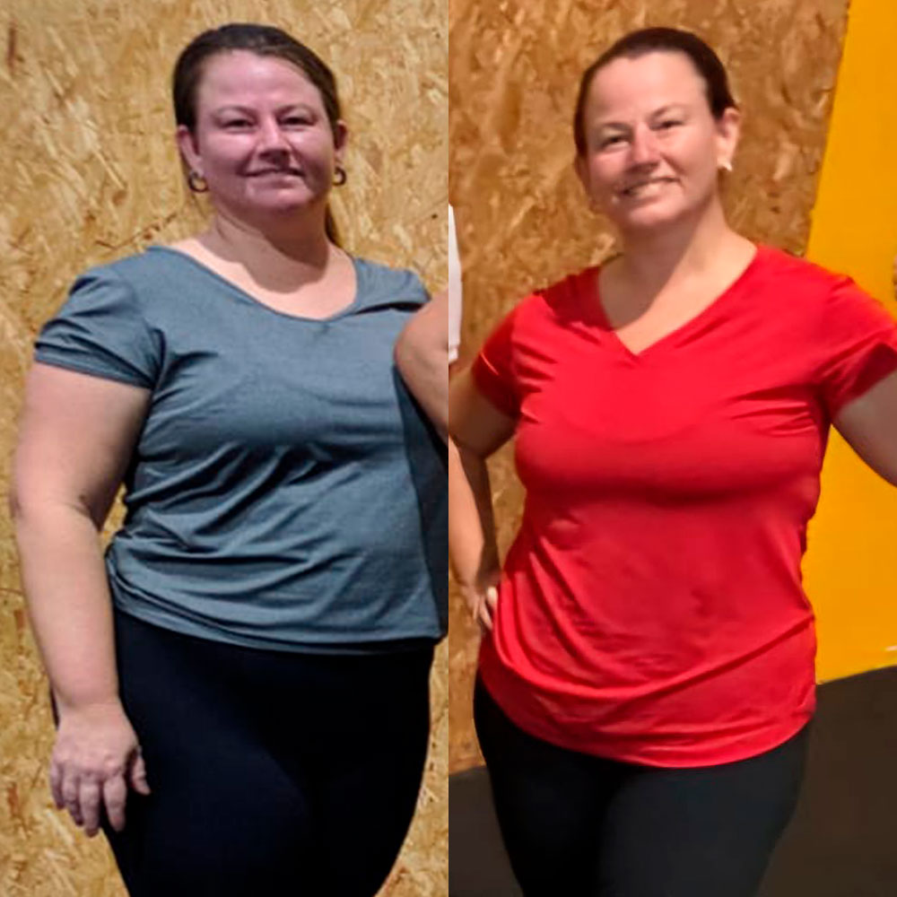 antes-depois-5